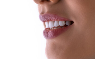 Sourire éclatant